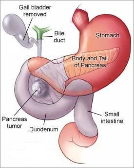 pancreas image